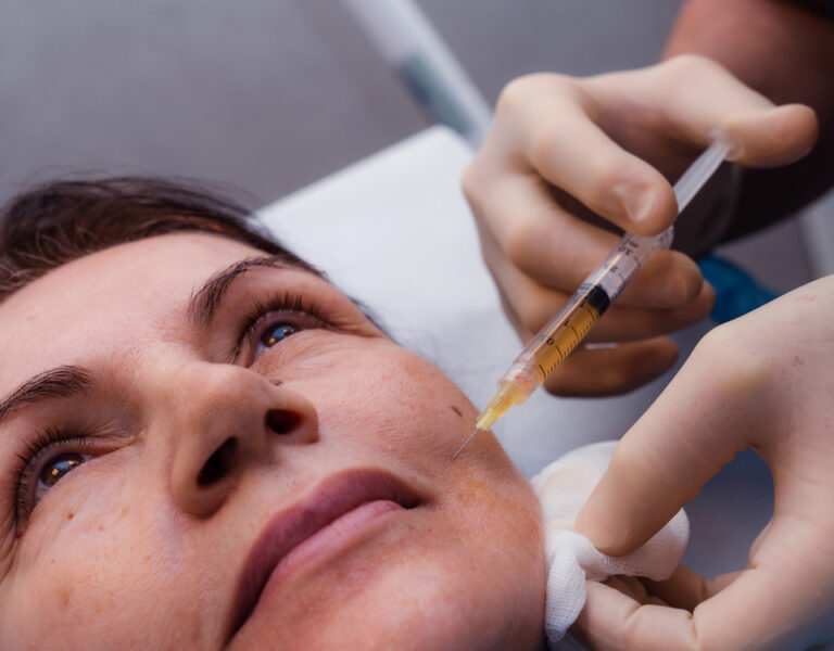 Siringa Trattamento PRP Plasma Ricco di Piastrine