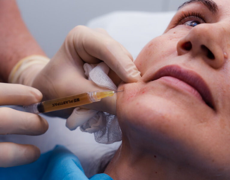 Siringa Trattamento PRP Plasma Ricco di Piastrine