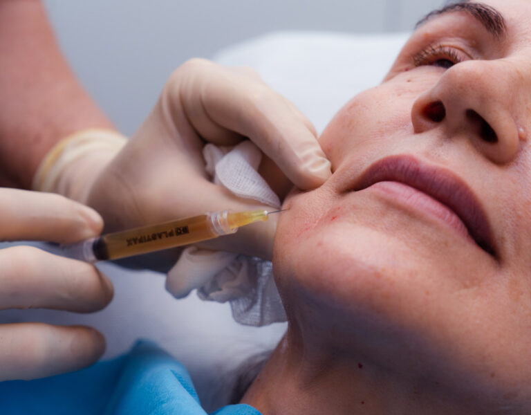 Siringa Trattamento PRP Plasma Ricco di Piastrine