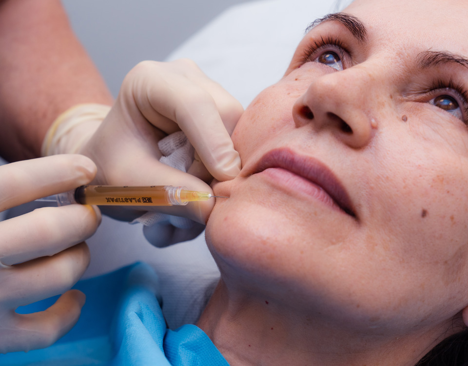 Siringa Trattamento PRP Plasma Ricco di Piastrine