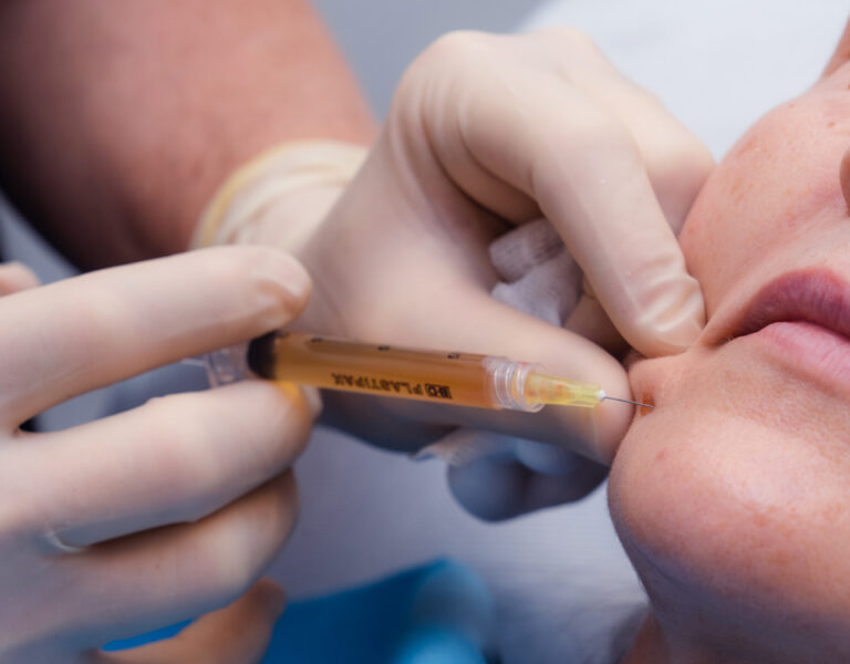 Siringa Trattamento PRP Plasma Ricco di Piastrine