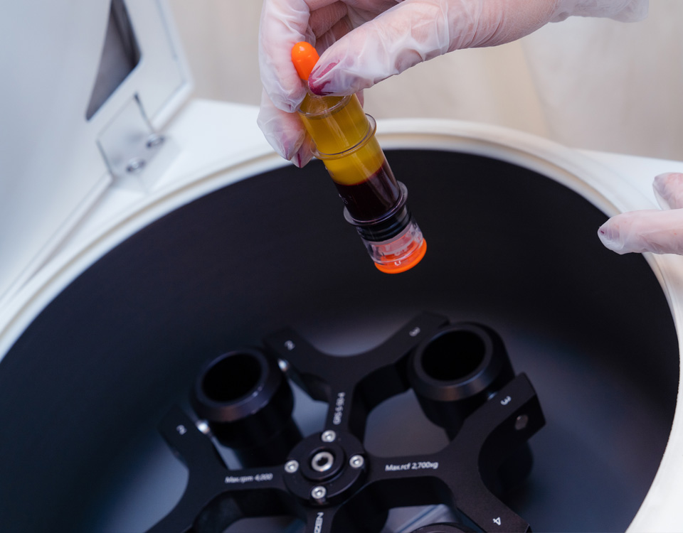 Centrifuga PRP