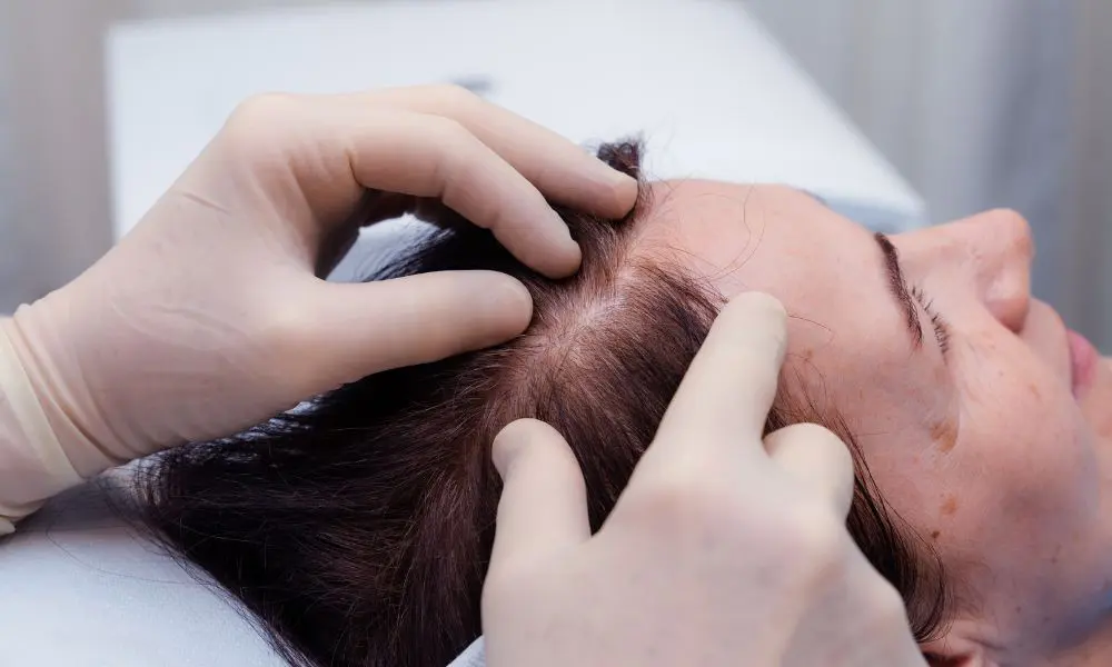 Cute di una donna con pochi capelli