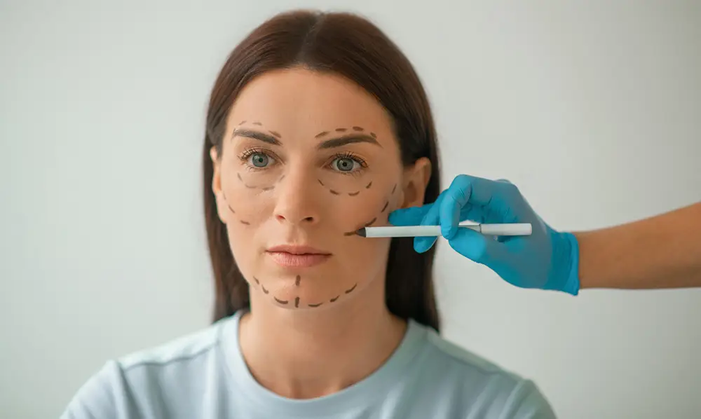 Donna con disegni sul viso prima di un'operazione di Chirurgia Estetica