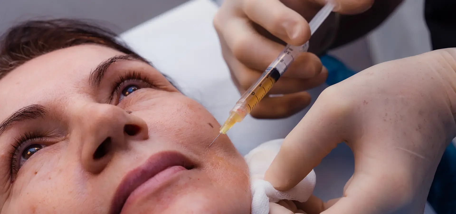 Iniezione di PRP (Plasma Ricco di Piastrine)